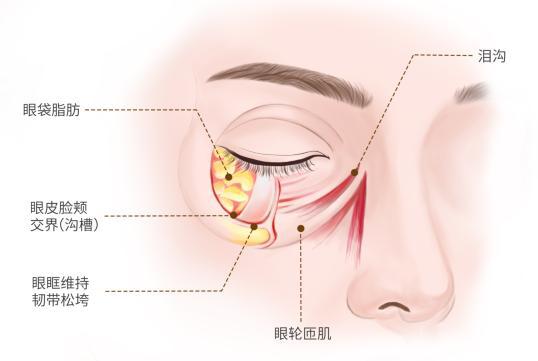 的标志去除眼袋焕发青春光彩龙8囯际眼袋不是自然衰老(图1)