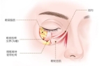 的标志去除眼袋焕发青春光彩龙8囯际眼袋不